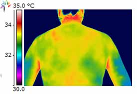 Thermography Neck Posterior