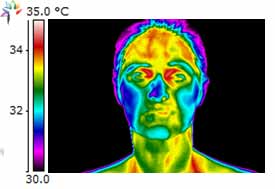 Thermography Sinus Infection