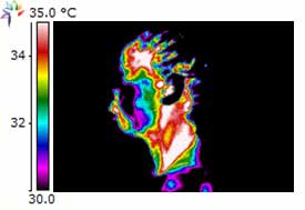 Thermography Image of TMJ left side of head